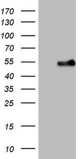 WTAP Antibody - HEK293T cells were transfected with the pCMV6-ENTRY control. (Left lane) or pCMV6-ENTRY WTAP. (Right lane) cDNA for 48 hrs and lysed. Equivalent amounts of cell lysates. (5 ug per lane) were separated by SDS-PAGE and immunoblotted with anti-WTAP. (1:2000)
