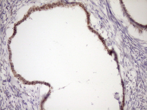 WTAP Antibody - Immunohistochemical staining of paraffin-embedded Human Ovary tissue within the normal limits using anti-WTAP mouse monoclonal antibody. (Heat-induced epitope retrieval by Tris-EDTA, pH8.0)(1:150)