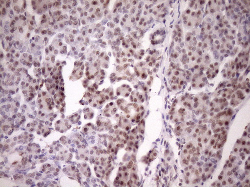 WTAP Antibody - IHC of paraffin-embedded Human pancreas tissue using anti-WTAP mouse monoclonal antibody. (Heat-induced epitope retrieval by Tris-EDTA, pH8.0)(1:150).
