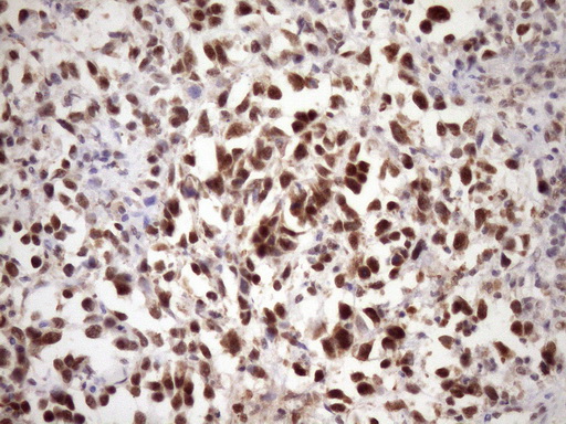 WTAP Antibody - IHC of paraffin-embedded Human bladder tissue using anti-WTAP mouse monoclonal antibody. (Heat-induced epitope retrieval by Tris-EDTA, pH8.0)(1:150).
