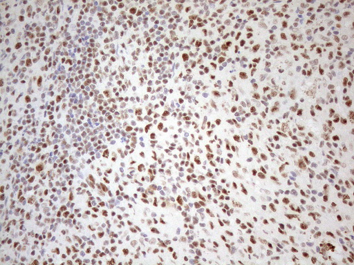 WTAP Antibody - Immunohistochemical staining of paraffin-embedded Human lymph node tissue using anti-WTAP mouse monoclonal antibody. (Heat-induced epitope retrieval by 1mM EDTA in 10mM Tris buffer. (pH8.5) at 120°C for 3 min. (1:150)