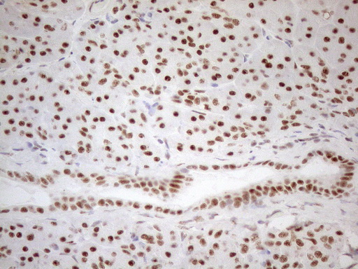 WTAP Antibody - Immunohistochemical staining of paraffin-embedded Human pancreas tissue using anti-WTAP mouse monoclonal antibody. (Heat-induced epitope retrieval by 1mM EDTA in 10mM Tris buffer. (pH8.5) at 120°C for 3 min. (1:150)