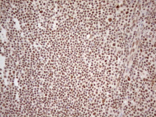 WTAP Antibody - Immunohistochemical staining of paraffin-embedded Human tonsil using anti-WTAP mouse monoclonal antibody. (Heat-induced epitope retrieval by 1mM EDTA in 10mM Tris buffer. (pH8.5) at 120°C for 3 min. (1:150)