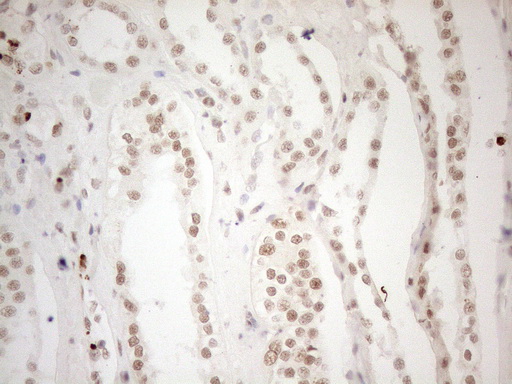 WTAP Antibody - Immunohistochemical staining of paraffin-embedded Human Kidney tissue using anti-WTAP mouse monoclonal antibody. (Heat-induced epitope retrieval by 1mM EDTA in 10mM Tris buffer. (pH8.5) at 120°C for 3 min. (1:150)