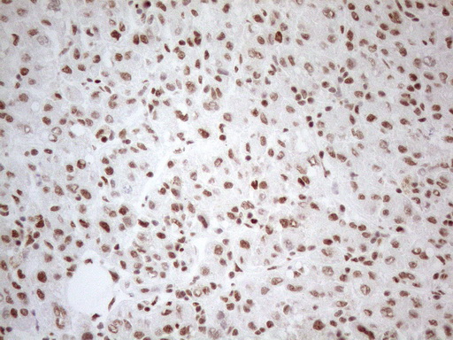 WTAP Antibody - Immunohistochemical staining of paraffin-embedded Human liver tissue using anti-WTAP mouse monoclonal antibody. (Heat-induced epitope retrieval by 1mM EDTA in 10mM Tris buffer. (pH8.5) at 120°C for 3 min. (1:150)