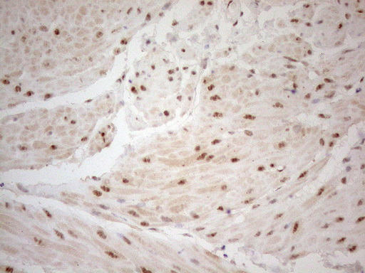 WTAP Antibody - Immunohistochemical staining of paraffin-embedded Human lung tissue using anti-WTAP mouse monoclonal antibody. (Heat-induced epitope retrieval by 1mM EDTA in 10mM Tris buffer. (pH8.5) at 120°C for 3 min. (1:150)