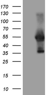 WTAP Antibody - HEK293T cells were transfected with the pCMV6-ENTRY control. (Left lane) or pCMV6-ENTRY WTAP. (Right lane) cDNA for 48 hrs and lysed. Equivalent amounts of cell lysates. (5 ug per lane) were separated by SDS-PAGE and immunoblotted with anti-WTAP. (1:2000)