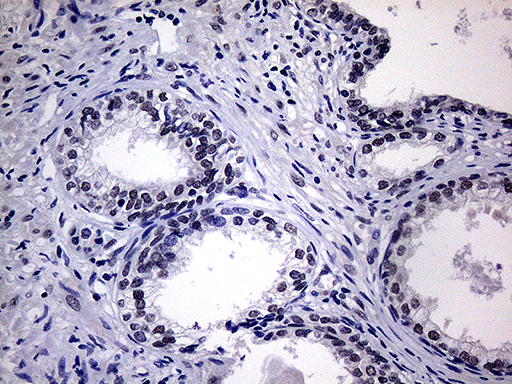 WTAP Antibody - Immunohistochemical staining of paraffin-embedded Human prostate tissue within the normal limits using anti-WTAP mouse monoclonal antibody. (Heat-induced epitope retrieval by 1mM EDTA in 10mM Tris buffer. (pH8.5) at 120°C for 3 min. (1:2000)