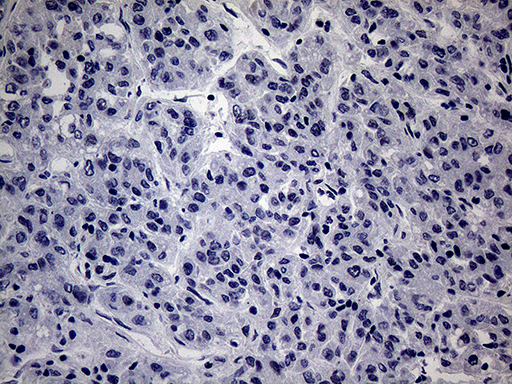 WTAP Antibody - Immunohistochemical staining of paraffin-embedded Human liver tissue within the normal limits using anti-WTAP mouse monoclonal antibody. This figure shows negative staining. (Heat-induced epitope retrieval by 1mM EDTA in 10mM Tris buffer. (pH8.5) at 120°C for 3 min. (1:2000)