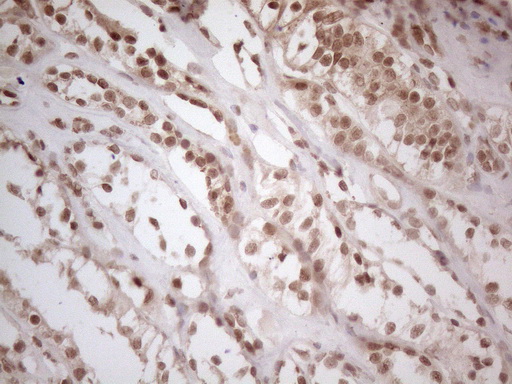 WTAP Antibody - Immunohistochemical staining of paraffin-embedded Human Kidney tissue within the normal limits using anti-WTAP mouse monoclonal antibody. (Heat-induced epitope retrieval by 1mM EDTA in 10mM Tris buffer. (pH8.5) at 120°C for 3 min. (1:150)