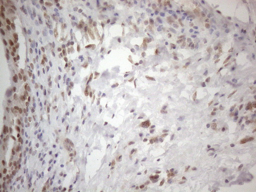 WTAP Antibody - Immunohistochemical staining of paraffin-embedded Human bladder tissue within the normal limits using anti-WTAP mouse monoclonal antibody. (Heat-induced epitope retrieval by 1mM EDTA in 10mM Tris buffer. (pH8.5) at 120°C for 3 min. (1:150)