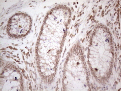 WTAP Antibody - Immunohistochemical staining of paraffin-embedded Human colon tissue within the normal limits using anti-WTAP mouse monoclonal antibody. (Heat-induced epitope retrieval by 1mM EDTA in 10mM Tris buffer. (pH8.5) at 120°C for 3 min. (1:150)