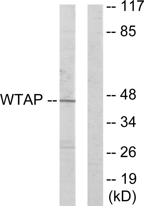 WTAP Antibody - Western blot analysis of lysates from HUVEC cells, using WTAP Antibody. The lane on the right is blocked with the synthesized peptide.