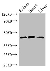 WTAP Antibody - Positive WB detected in:Mouse kidney tissue,Rat heart tissue,Rat liver tissue;All lanes:WTAP antibody at 3?g/ml;Secondary;Goat polyclonal to rabbit IgG at 1/50000 dilution;Predicted band size:45,18 KDa;Observed band size: 45 KDa;