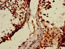 WTAP Antibody - Immunohistochemistry of paraffin-embedded human testis tissue using WTAP Antibody at dilution of 1:100