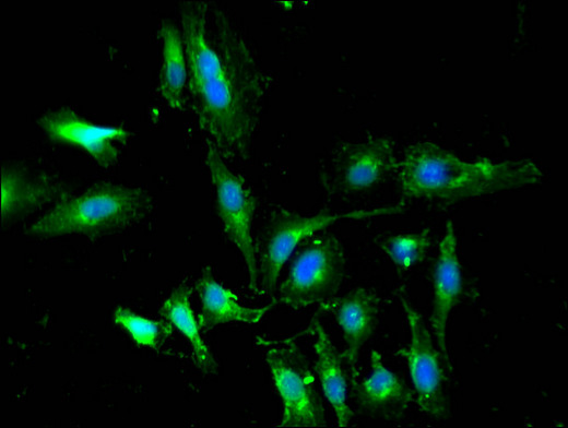 WTAP Antibody - Immunofluorescent analysis of Hela cells using WTAP Antibody at a dilution of 1:100 and Alexa Fluor 488-congugated AffiniPure Goat Anti-Rabbit IgG(H+L)