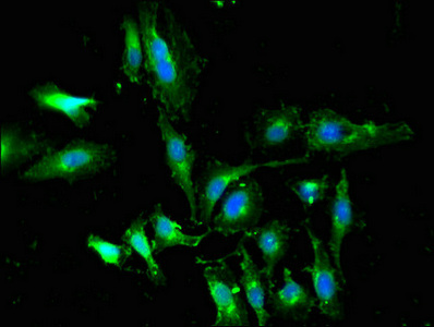WTAP Antibody - Immunofluorescent analysis of Hela cells using WTAP Antibody at dilution of 1:100 and Alexa Fluor 488-congugated AffiniPure Goat Anti-Rabbit IgG(H+L)