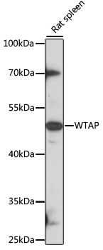 WTAP Antibody - Western blot analysis of extracts of rat spleen, using WTAP antibody at 1:1000 dilution. The secondary antibody used was an HRP Goat Anti-Rabbit IgG (H+L) at 1:10000 dilution. Lysates were loaded 25ug per lane and 3% nonfat dry milk in TBST was used for blocking. An ECL Kit was used for detection and the exposure time was 90s.