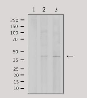 WTAP Antibody - Western blot analysis of extracts of various samples using WTAP antibody. Lane 1: mouse brain treated with blocking peptide; Lane 2: mouse brain; Lane 3: rat brain;