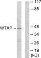 WTAP Antibody - Western blot analysis of extracts from HUVEC cells, using WTAP antibody.