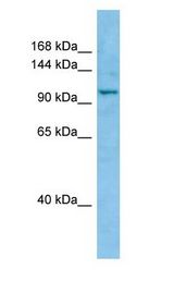 WWC1 / KIBRA Antibody - WWC1 / KIBRA antibody Western Blot of PANC1.  This image was taken for the unconjugated form of this product. Other forms have not been tested.
