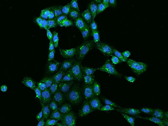WWC1 / KIBRA Antibody - Immunofluorescence staining of WWC1 in A431 cells. Cells were fixed with 4% PFA, permeabilzed with 0.1% Triton X-100 in PBS, blocked with 10% serum, and incubated with rabbit anti-Human WWC1 polyclonal antibody (dilution ratio 1:500) at 4°C overnight. Then cells were stained with the Alexa Fluor 488-conjugated Goat Anti-rabbit IgG secondary antibody (green) and counterstained with DAPI (blue). Positive staining was localized to Cytoplasm.