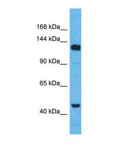 WWC2 Antibody - Western blot of Human MCF7. WWC2 antibody dilution 1.0 ug/ml.  This image was taken for the unconjugated form of this product. Other forms have not been tested.