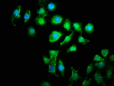 WWC2 Antibody - Immunofluorescence staining of A549 cells with WWC2 Antibody at 1:133, counter-stained with DAPI. The cells were fixed in 4% formaldehyde, permeabilized using 0.2% Triton X-100 and blocked in 10% normal Goat Serum. The cells were then incubated with the antibody overnight at 4°C. The secondary antibody was Alexa Fluor 488-congugated AffiniPure Goat Anti-Rabbit IgG(H+L).
