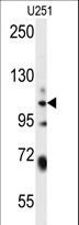 WWC3 Antibody - WWC3 Antibody western blot of U251 cell line lysates (35 ug/lane). The WWC3 antibody detected the WWC3 protein (arrow).