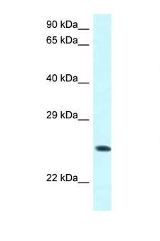 WWOX Antibody - WWOX antibody Western blot of COL0205 Cell lysate. Antibody concentration 1 ug/ml.  This image was taken for the unconjugated form of this product. Other forms have not been tested.