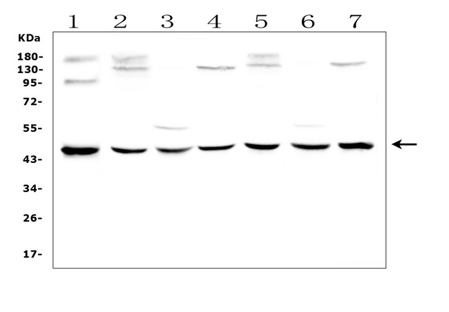 WWOX Antibody - Western blot analysis of WWOX using anti-WWOX antibody. Electrophoresis was performed on a 5-20% SDS-PAGE gel at 70V (Stacking gel) / 90V (Resolving gel) for 2-3 hours. The sample well of each lane was loaded with 50ug of sample under reducing conditions. Lane 1: human MCF-7 whole cell lysates, Lane 2: rat brain tissue lysates,Lane 3: rat kidney tissue lysates,Lane 4: rat testis tissue lysates,Lane 5: mouse brain tissue lysates,Lane 6: mouse kidney tissue lysates,Lane 7: mouse testis tissue lysates. After Electrophoresis, proteins were transferred to a Nitrocellulose membrane at 150mA for 50-90 minutes. Blocked the membrane with 5% Non-fat Milk/ TBS for 1.5 hour at RT. The membrane was incubated with rabbit anti-WWOX antigen affinity purified polyclonal antibody at 0.5 µg/mL overnight at 4°C, then washed with TBS-0.1% Tween 3 times with 5 minutes each and probed with a goat anti-rabbit IgG-HRP secondary antibody at a dilution of 1:10000 for 1.5 hour at RT. The signal is developed using an Enhanced Chemiluminescent detection (ECL) kit with Tanon 5200 system. A specific band was detected for WWOX at approximately 46KD. The expected band size for WWOX is at 46KD.