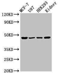 WWOX Antibody - Positive Western Blot detected in MCF-7 whole cell lysate, U87 whole cell lysate, HEK293 whole cell lysate, Rat kidney tissue. All lanes: WWOX antibody at 3 µg/ml Secondary Goat polyclonal to rabbit IgG at 1/50000 dilution. Predicted band size: 47, 42, 22, 5, 27 KDa. Observed band size: 47 KDa