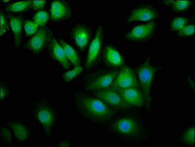 WWOX Antibody - Immunofluorescence staining of A549 cells with WWOX Antibody at 1:100, counter-stained with DAPI. The cells were fixed in 4% formaldehyde, permeabilized using 0.2% Triton X-100 and blocked in 10% normal Goat Serum. The cells were then incubated with the antibody overnight at 4°C. The secondary antibody was Alexa Fluor 488-congugated AffiniPure Goat Anti-Rabbit IgG(H+L).