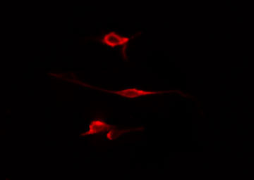 WWOX Antibody - Staining HepG2 cells by IF/ICC. The samples were fixed with PFA and permeabilized in 0.1% Triton X-100, then blocked in 10% serum for 45 min at 25°C. The primary antibody was diluted at 1:200 and incubated with the sample for 1 hour at 37°C. An Alexa Fluor 594 conjugated goat anti-rabbit IgG (H+L) antibody, diluted at 1/600, was used as secondary antibody.