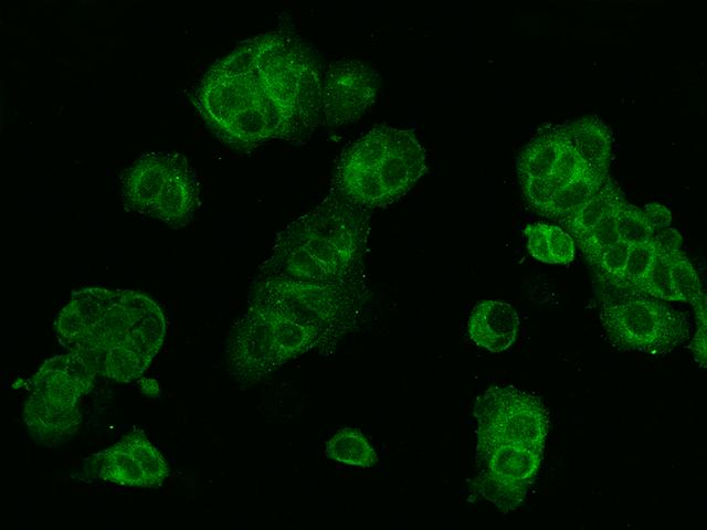 WWOX Antibody - Immunofluorescence staining of WWOX in MCF7 cells. Cells were fixed with 4% PFA, permeabilzed with 0.1% Triton X-100 in PBS, blocked with 10% serum, and incubated with rabbit anti-Human WWOX polyclonal antibody (dilution ratio 1:200) at 4°C overnight. Then cells were stained with the Alexa Fluor 488-conjugated Goat Anti-rabbit IgG secondary antibody (green). Positive staining was localized to Cytoplasm.