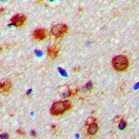 WWOX Antibody - Immunohistochemical analysis of WWOX staining in human brain formalin fixed paraffin embedded tissue section. The section was pre-treated using heat mediated antigen retrieval with sodium citrate buffer (pH 6.0). The section was then incubated with the antibody at room temperature and detected using an HRP conjugated compact polymer system. DAB was used as the chromogen. The section was then counterstained with hematoxylin and mounted with DPX.