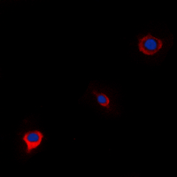 WWOX Antibody - Immunofluorescent analysis of WWOX staining in A549 cells. Formalin-fixed cells were permeabilized with 0.1% Triton X-100 in TBS for 5-10 minutes and blocked with 3% BSA-PBS for 30 minutes at room temperature. Cells were probed with the primary antibody in 3% BSA-PBS and incubated overnight at 4 deg C in a humidified chamber. Cells were washed with PBST and incubated with a DyLight 594-conjugated secondary antibody (red) in PBS at room temperature in the dark. DAPI was used to stain the cell nuclei (blue).