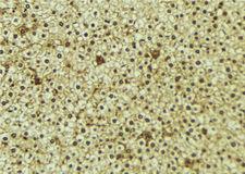 WWP1 Antibody - 1:100 staining mouse liver tissue by IHC-P. The sample was formaldehyde fixed and a heat mediated antigen retrieval step in citrate buffer was performed. The sample was then blocked and incubated with the antibody for 1.5 hours at 22°C. An HRP conjugated goat anti-rabbit antibody was used as the secondary.