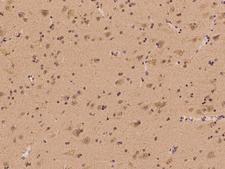 WWP1 Antibody - Immunochemical staining of human WWP1 in human brain with rabbit polyclonal antibody at 1:100 dilution, formalin-fixed paraffin embedded sections.