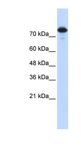 WWP2 Antibody - WWP2 antibody Western blot of Transfected 293T cell lysate. This image was taken for the unconjugated form of this product. Other forms have not been tested.