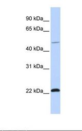 WWP2 Antibody - 721_B cell lysate. Antibody concentration: 1.0 ug/ml. Gel concentration: 12%.  This image was taken for the unconjugated form of this product. Other forms have not been tested.