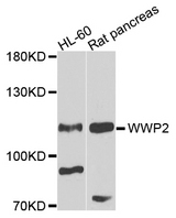 WWP2 Antibody - Western blot analysis of extracts of HL-60 cells and rat tissue.