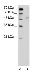 WWP2 Antibody - A: Marker, B: Jurkat Cell Lysate.  This image was taken for the unconjugated form of this product. Other forms have not been tested.