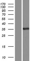 WWP2 Protein - Western validation with an anti-DDK antibody * L: Control HEK293 lysate R: Over-expression lysate