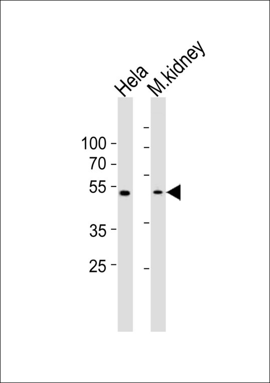WWTR1 / TAZ Antibody - Western blot of lysates from HeLa cell line and mouse kidney tissue (from left to right) with WWTR1 Antibody. Antibody was diluted at 1:1000 at each lane. A goat anti-rabbit IgG H&L (HRP) at 1:10000 dilution was used as the secondary antibody. Lysates at 20 ug per lane.
