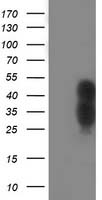 WWTR1 / TAZ Antibody - HEK293T cells were transfected with the pCMV6-ENTRY control (Left lane) or pCMV6-ENTRY WWTR1 (Right lane) cDNA for 48 hrs and lysed. Equivalent amounts of cell lysates (5 ug per lane) were separated by SDS-PAGE and immunoblotted with anti-WWTR1.