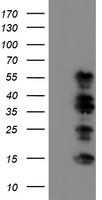 WWTR1 / TAZ Antibody - HEK293T cells were transfected with the pCMV6-ENTRY control (Left lane) or pCMV6-ENTRY WWTR1 (Right lane) cDNA for 48 hrs and lysed. Equivalent amounts of cell lysates (5 ug per lane) were separated by SDS-PAGE and immunoblotted with anti-WWTR1.