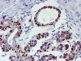 WWTR1 / TAZ Antibody - IHC of paraffin-embedded Human breast tissue using anti-WWTR1 mouse monoclonal antibody.