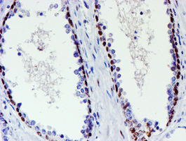 WWTR1 / TAZ Antibody - IHC of paraffin-embedded Human prostate tissue using anti-WWTR1 mouse monoclonal antibody.