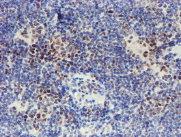 WWTR1 / TAZ Antibody - IHC of paraffin-embedded Human lymphoma tissue using anti-WWTR1 mouse monoclonal antibody.